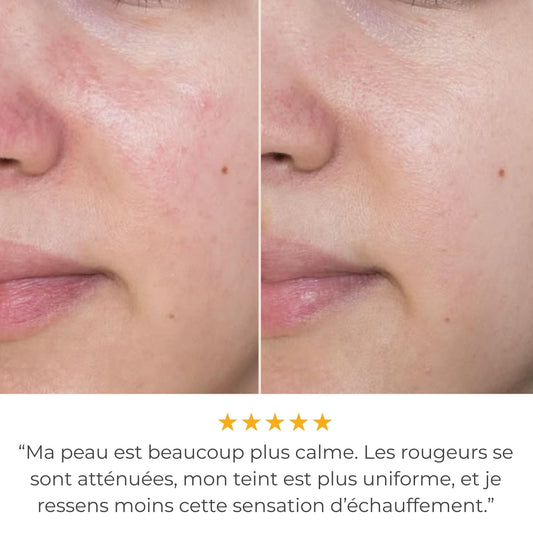 ClearPulse™ 2.0 - Haute Fréquence Thérapeutique Anti-Acné