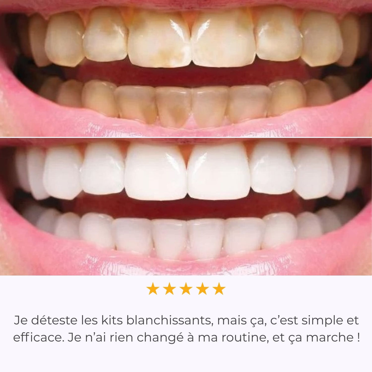 IVISMILE – Brosse à dents LED pour un sourire lumineux sans effort